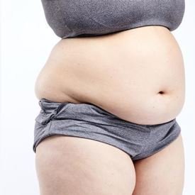 Tummy tuck Before & After Photos in View Plastic Surgery Hospital