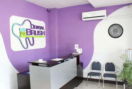 Find Ceramic Braces prices at My Dental Brush Mexicali
