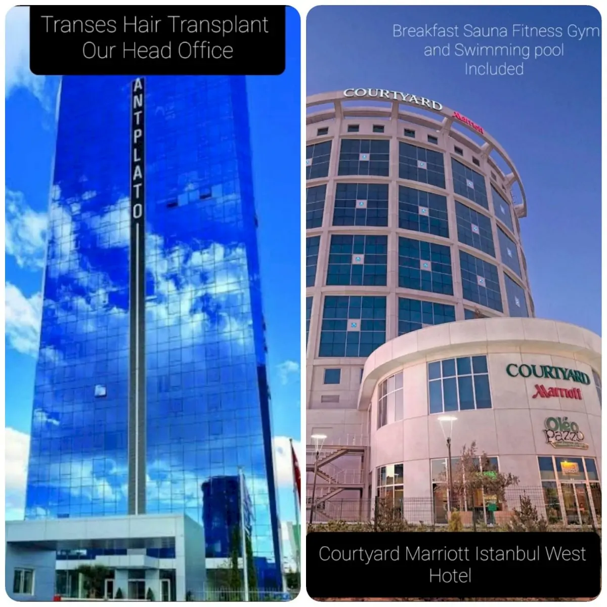 Transes Hair Transplant Center
