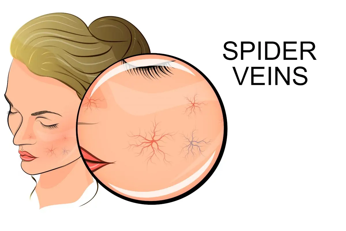Vein Clinic Alanya