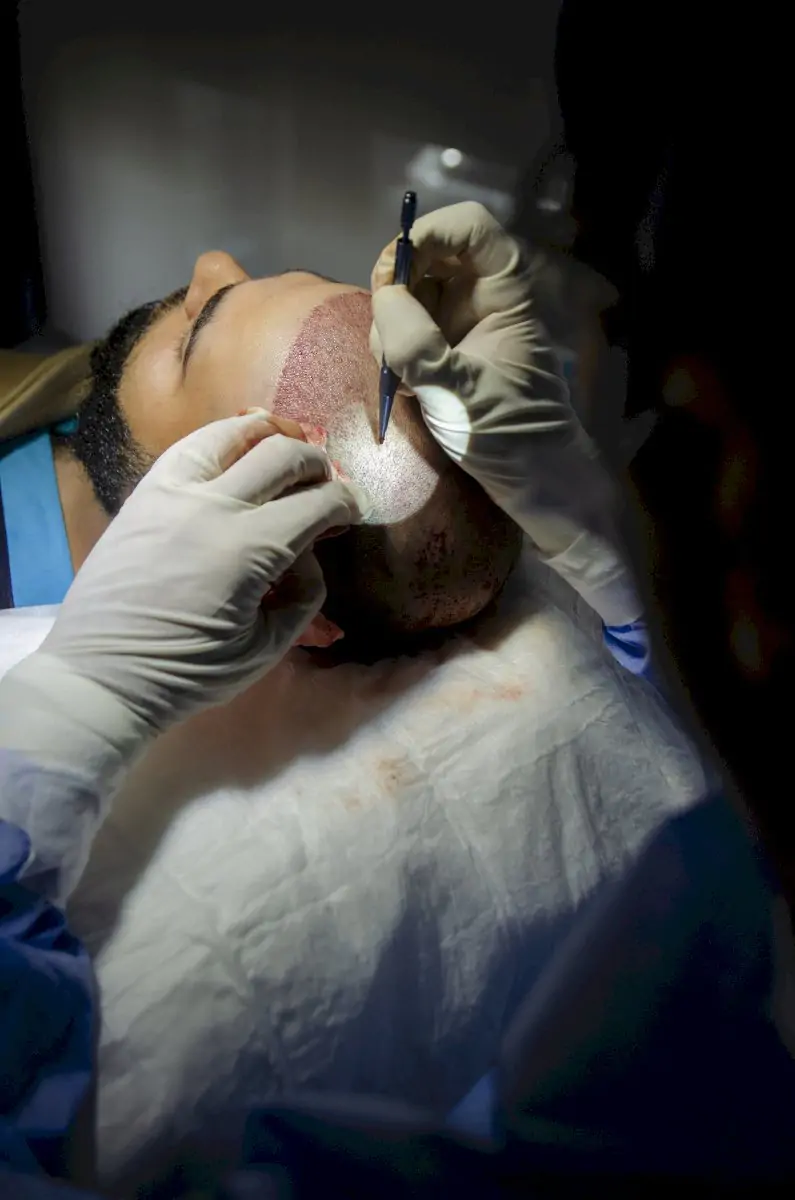 Smile Hair Clinic | Hair Transplant In Turkey