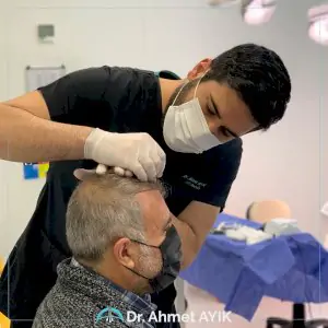 إجراء زراعة الشعر في عيادة Ahmet Ayık Hair Transplant، إسطنبول