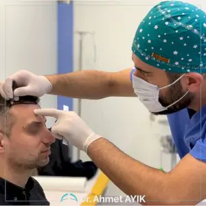 استشارة زراعة الشعر في عيادة Ahmet Ayık Hair Transplant، اسطنبول