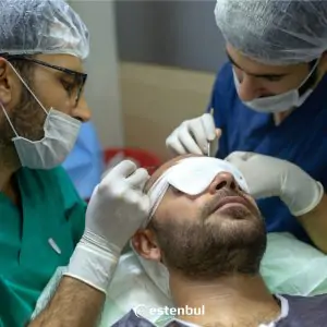 إجراء زراعة الشعر في عيادة Estenbul Health مع الفريق الطبي