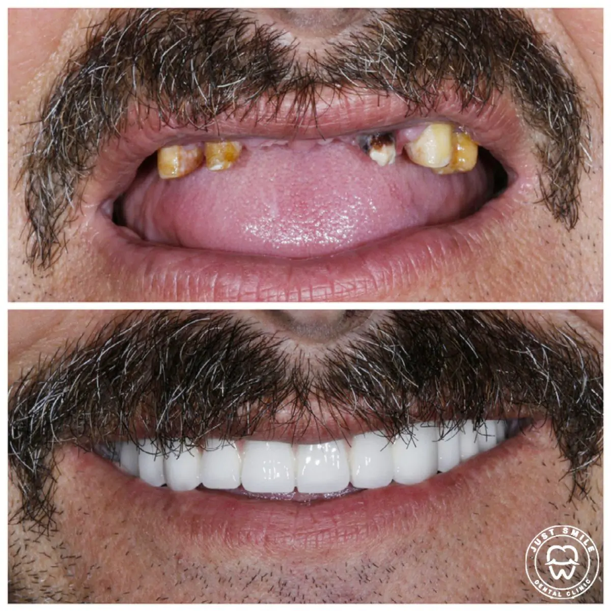 Just Smile Dental Clinic