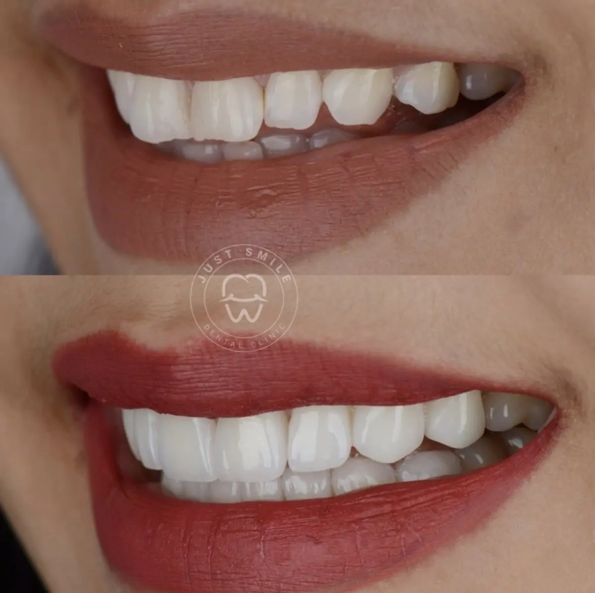 Just Smile Dental Clinic