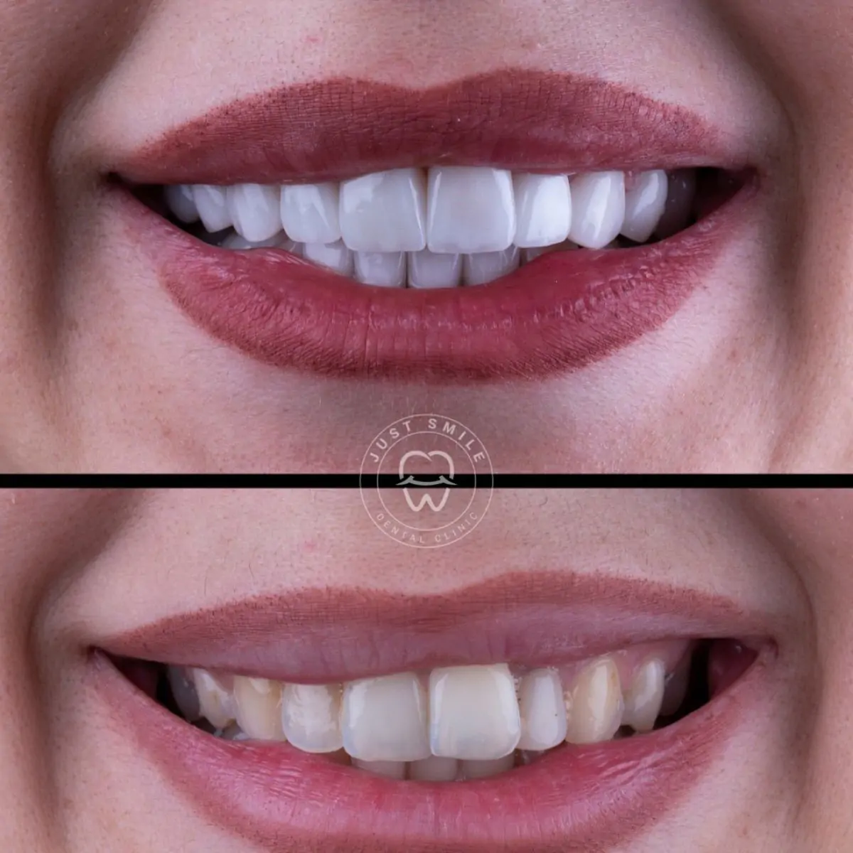 Just Smile Dental Clinic