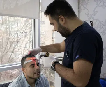 استشارة زراعة الشعر في Istanbul Hair Center مع أخصائي يستخدم أداة ليزر