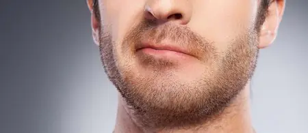 نتائج زراعة اللحية في Nu Cosmetic Clinic، استعادة شعر الوجه بشكل طبيعي