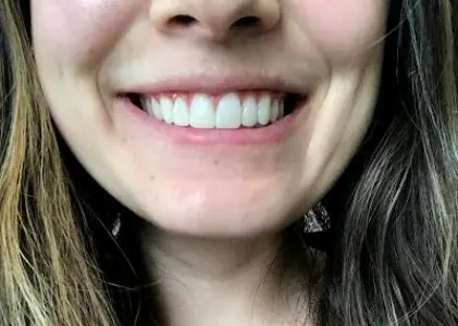 Sonrisa de paciente tras tratamiento dental en 360 Dental Care Ltd