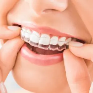 تقويم شفاف لتقويم الأسنان في Novos Dental Clinic