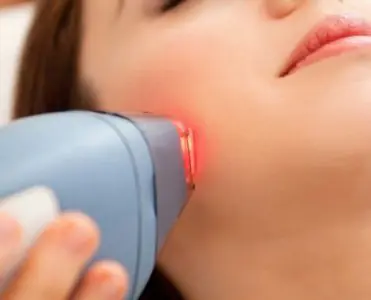 Tratamiento láser de la piel en Dr Ali Soueid Aesthetic & Plastic Surgeon