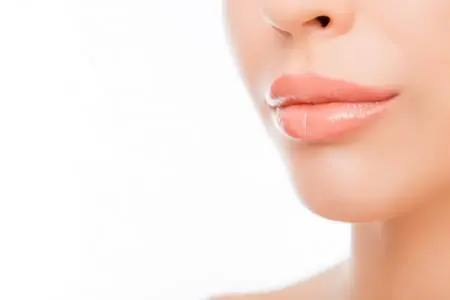 صورة مقربة للشفاه بعد علاج تجميلي في Gentle Dental Care