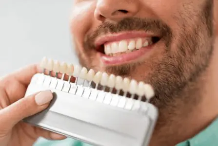 Selección de tono dental para carillas en Duthie Dental
