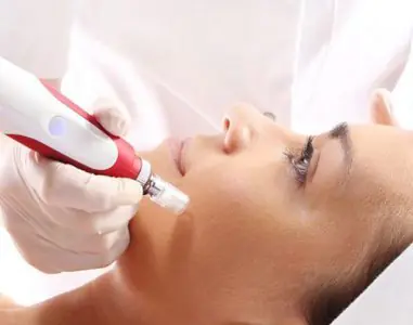 علاج الوجه بالميكرونيدلينغ في عيادة Aesthetica بجهاز حديث للأمراض الجلدية