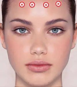 نقاط حقن الجبهة لإجراءات تجميلية في عيادة Freshfaced