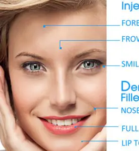 مخطط مناطق علاج تجميل الوجه في عيادة EH Dental Care