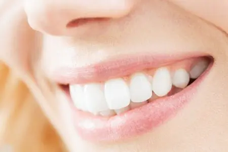 Sonrisa brillante tras tratamiento dental en Barbour Dental Care