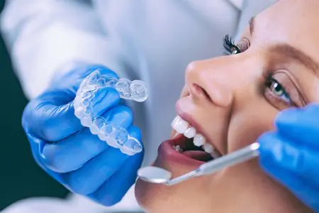 تركيب تقويم شفاف في عيادة Abbeymount Dental Care
