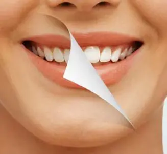 نتيجة تبييض الأسنان في عيادة One20 Dental