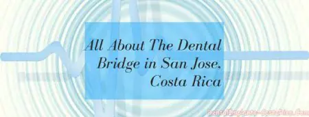 معلومات عن علاج الجسر السني في Dental Implants Costa Rica، سان خوسيه
