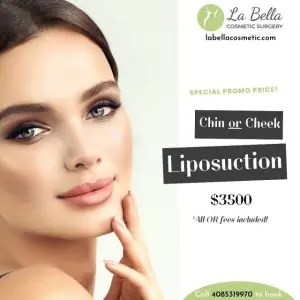 عرض ترويجي لجراحة La Bella للتجميل لشفط دهون الذقن أو الخد بسعر 3500 دولار