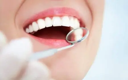 فحص أسنان في Thantakit Dental Center Pratunam Branch، لقطة مقربة لأسنان صحية