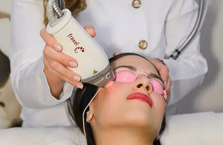 Tratamiento de piel con láser Fraxel en San Diego Cosmetic Laser Clinic