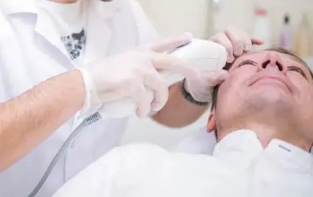 علاج ليزر للوجه في عيادة Gdansk Beauty Clinic، بولندا