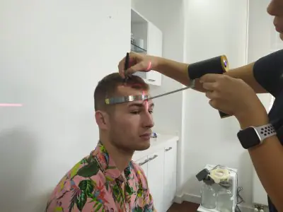استشارة زراعة الشعر في عيادة MCAN Health مع قياس فروة الرأس
