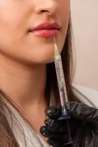إجراء حقن الفيلر للشفاه في عيادة PERFECT SKIN CANCÚN للتجميل