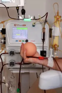 جهاز فصل مكونات الدم قيد الاستخدام في عيادة Moderne Apherese، معدات ترشيح دم متقدمة