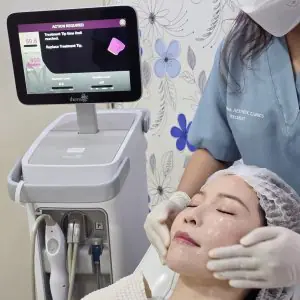 علاج تجديد البشرة بجهاز Thermage في عيادة ProDerma