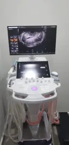 جهاز الموجات فوق الصوتية في INNOVA CLINIC PUNTA CANA للتصوير التشخيصي