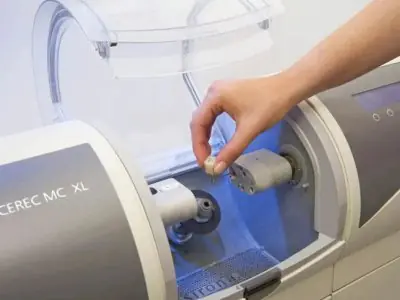 جهاز طحن الأسنان CEREC في عيادة KAIYEN International Dental Clinic
