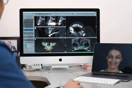 برنامج تخطيط زراعة الأسنان في عيادة KAIYEN International Dental Clinic