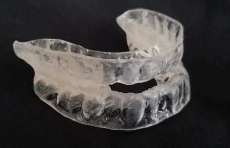 تقويم شفاف للأسنان لعلاج تقويمي في Tor Dental Clinic