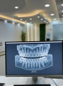 فحص أسنان ثلاثي الأبعاد على شاشة في منطقة استقبال Vienna Dental Clinic الحديثة