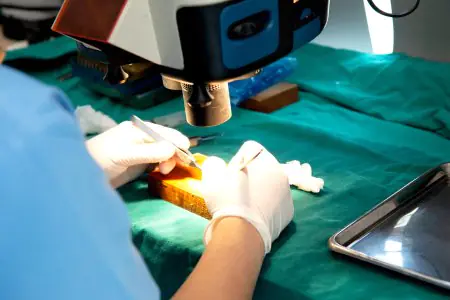 إجراء زراعة الشعر في Dr.Orn Medical Hair Center باستخدام مجهر جراحي