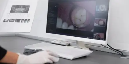 تشخيصات الأسنان في عيادة زارين باستخدام التصوير الرقمي وتحليل الأسنان