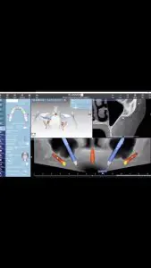 شاشة برنامج تخطيط زراعة الأسنان في عيادة Ortodoncia & Implantes