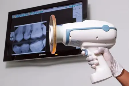 جهاز أشعة سينية رقمية وصور أسنان في Astra Dental Clinic