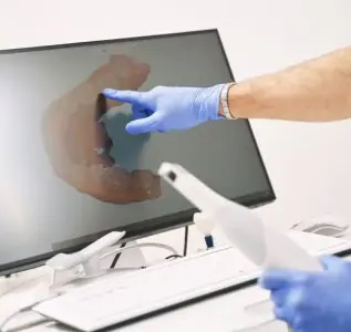 Escáner dental digital y modelo 3D de dientes en Funda Sarıkaya Dental Clinic