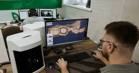 تصميم أسنان رقمي في Smile — Family Dentistry باستخدام معدات CAD/CAM متقدمة