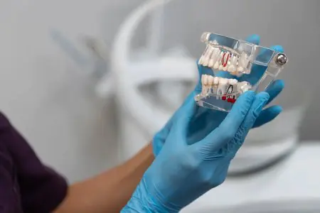 نموذج زراعة الأسنان في عيادة MEF Dental Grup