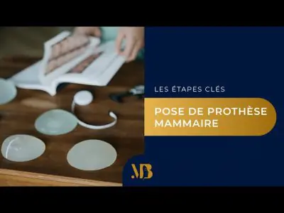 عينات حشوات الثدي وشريط قياس في غرفة استشارة عيادة الدكتور ميكائيل بينويليد