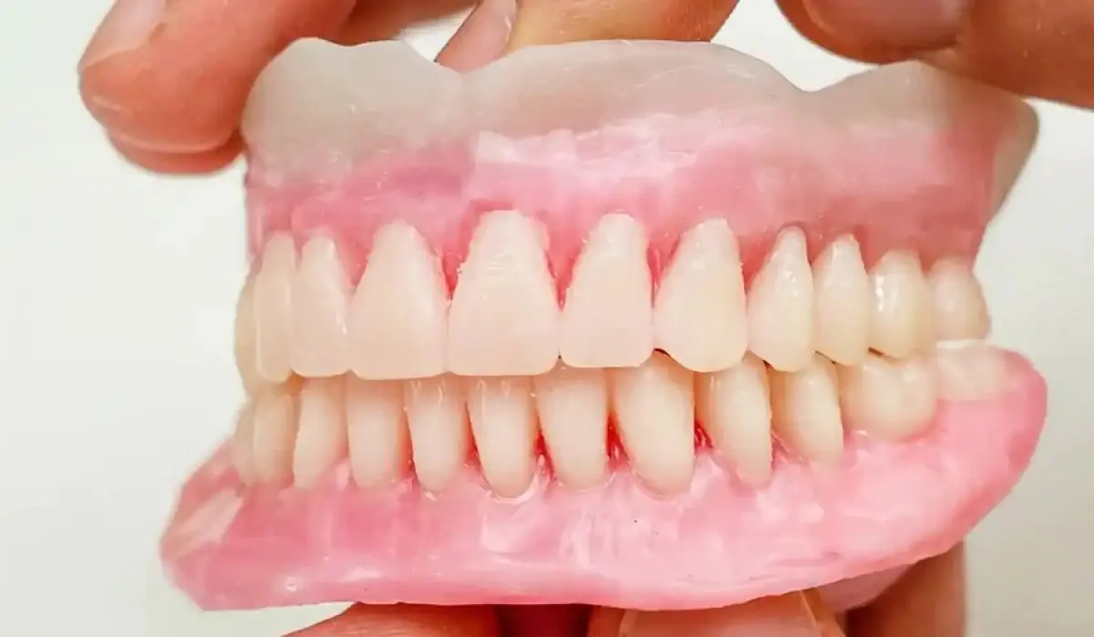 Full dental prosthesis model at Sunrise Dental Clinic