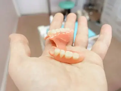 طقم أسنان قابل للإزالة في عيادة Dental Ciutat Vella، برشلونة
