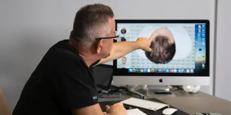 طبيب يحلل نتائج زراعة الشعر على الشاشة في عيادة ASMED لزراعة الشعر