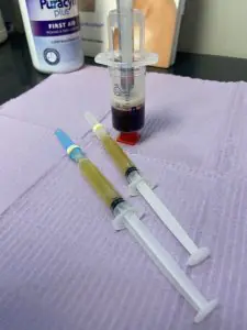 Jeringas de PRP con plasma y sangre en Seamless Health & Medical Aesthetics